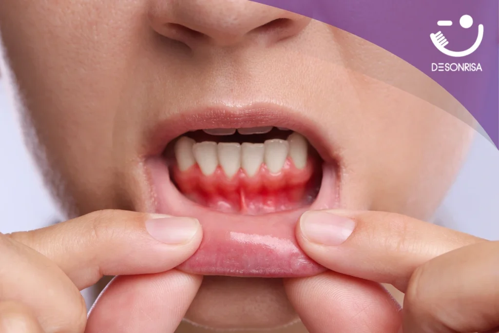 La epidemia silenciosa: Por qué buscar un dentista salud dental es clave ante la crisis de enfermedades bucales
